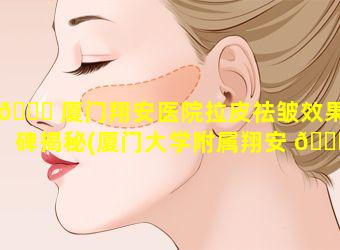 🕊 厦门翔安医院拉皮祛皱效果口碑揭秘(厦门大学附属翔安 🐝 医院皮肤科怎么样)